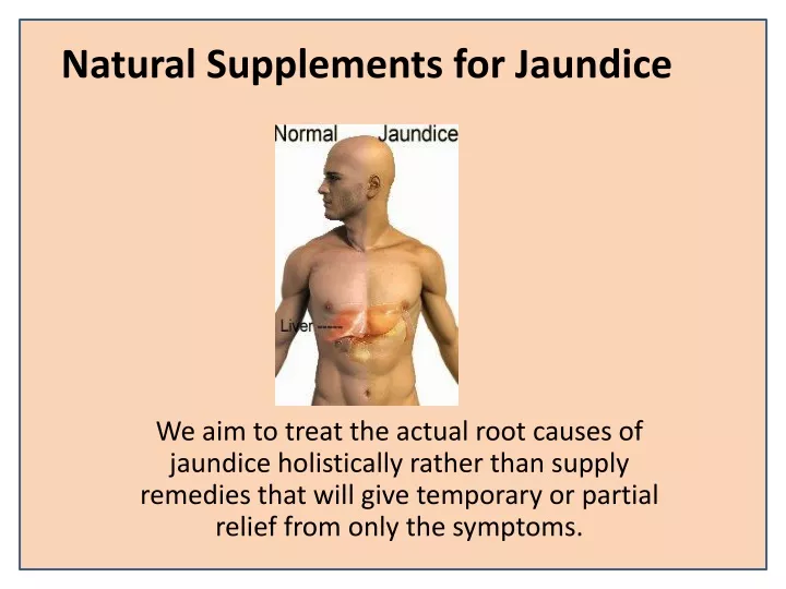 natural supplements for jaundice
