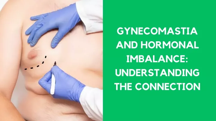 gynecomastia and hormonal imbalance understanding