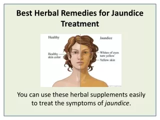 best herbal remedies for jaundice treatment