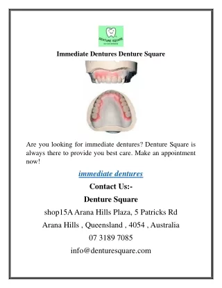 immediate dentures denture square
