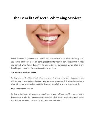 The Benefits of Teeth Whitening Services