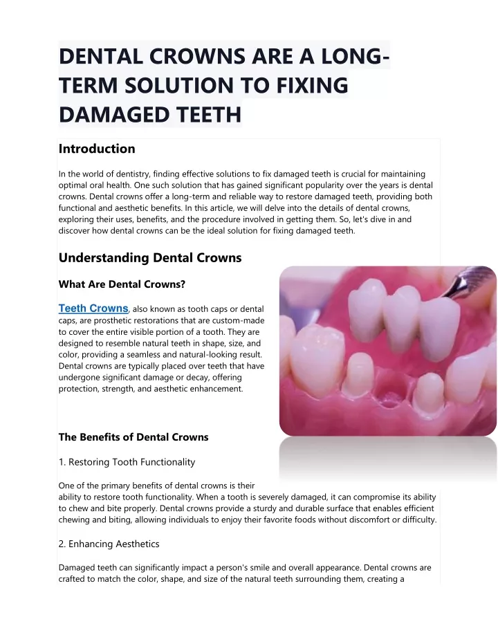 dental crowns are a long term solution to fixing