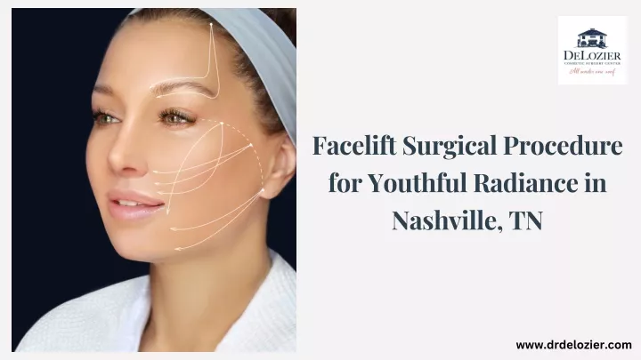 facelift surgical procedure for youthful radiance