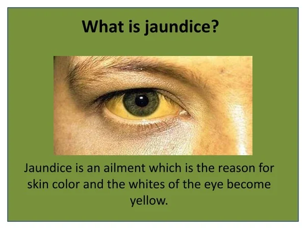 Herbal Remedies to Fight the Jaundice Disorder