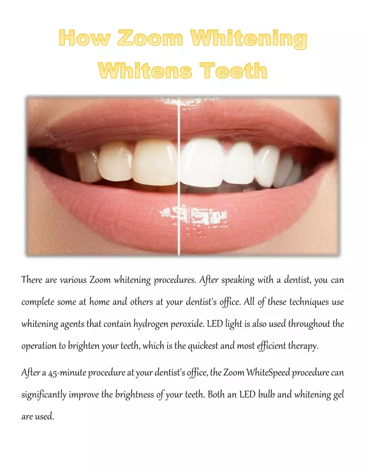 there are various zoom whitening procedures after