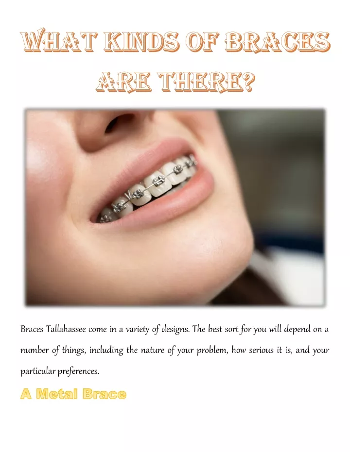 braces tallahassee come in a variety of designs