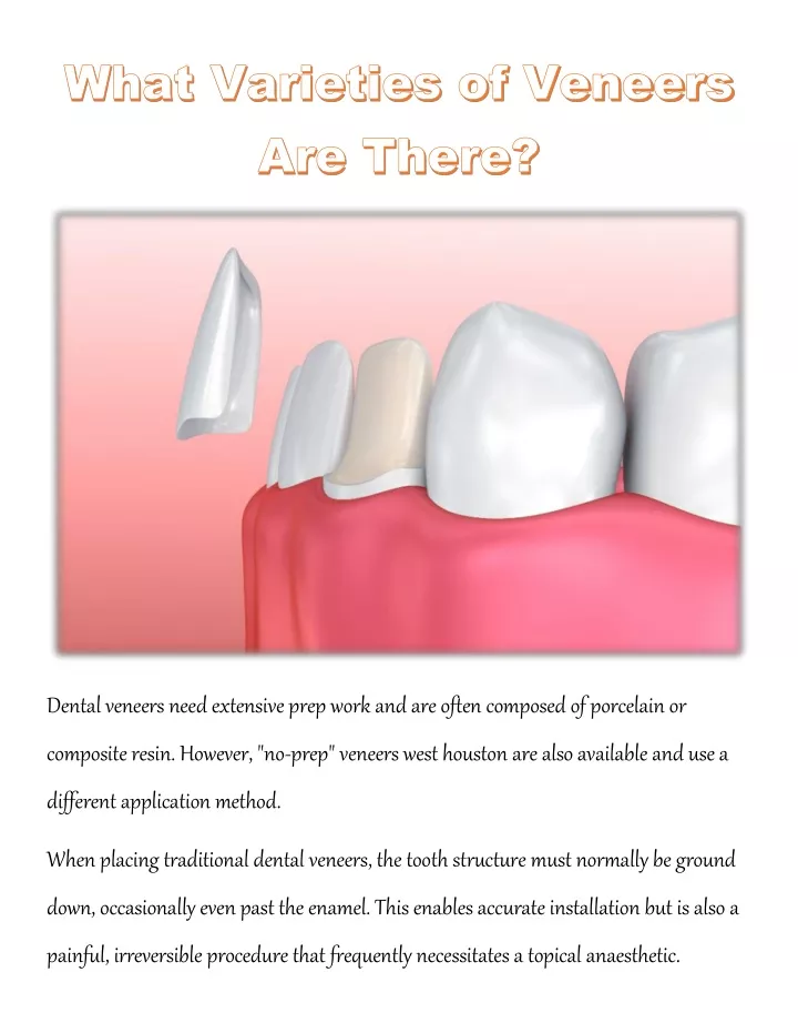 dental veneers need extensive prep work