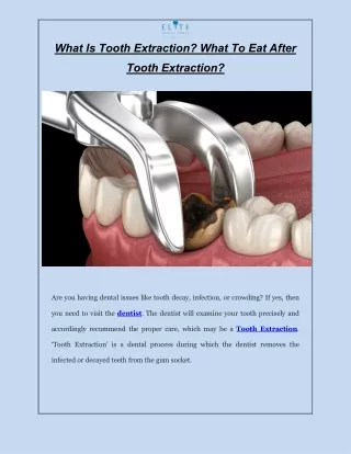 What Is Tooth Extraction What To Eat After Tooth Extraction?