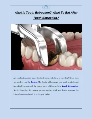 what is tooth extraction what to eat after