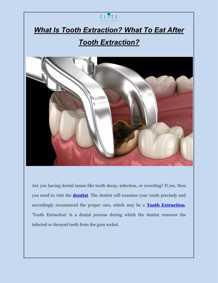what is tooth extraction what to eat after