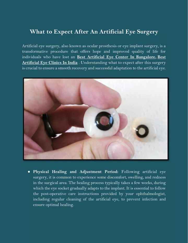 what to expect after an artificial eye surgery