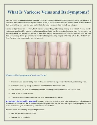What Is Varicose Veins and Its Symptoms?