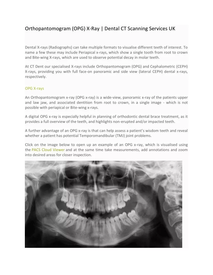 orthopantomogram opg x ray dental ct scanning
