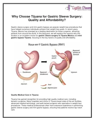 Why Choose Tijuana for Gastric Sleeve Surgery Quality and Affordability