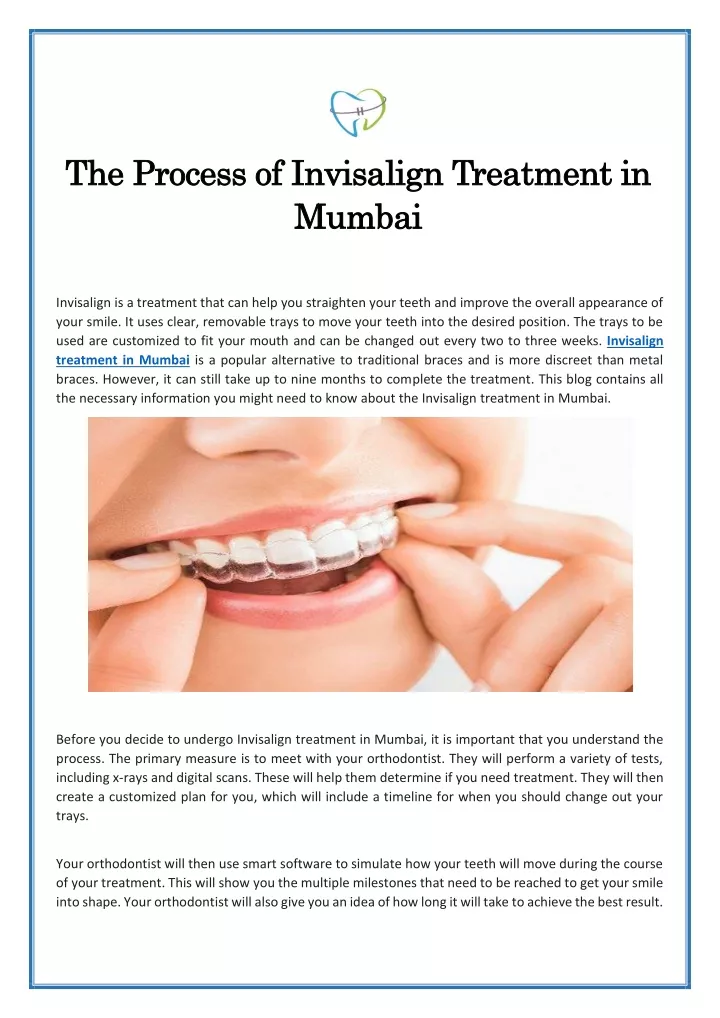 the process of invisalign treatment