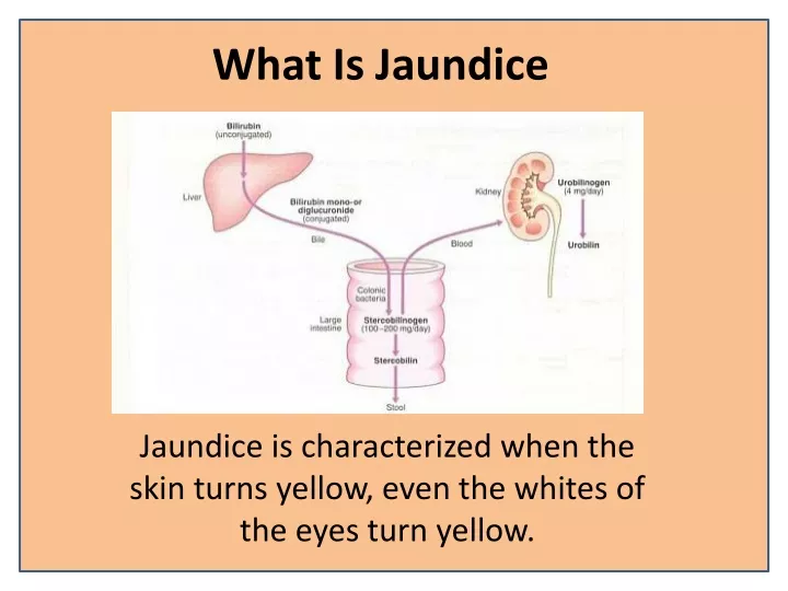 what is jaundice