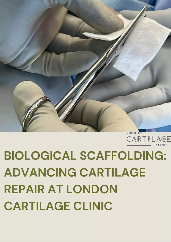 biological scaffolding advancing cartilage repair