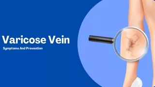 Symptoms & Prevention of varicose vein