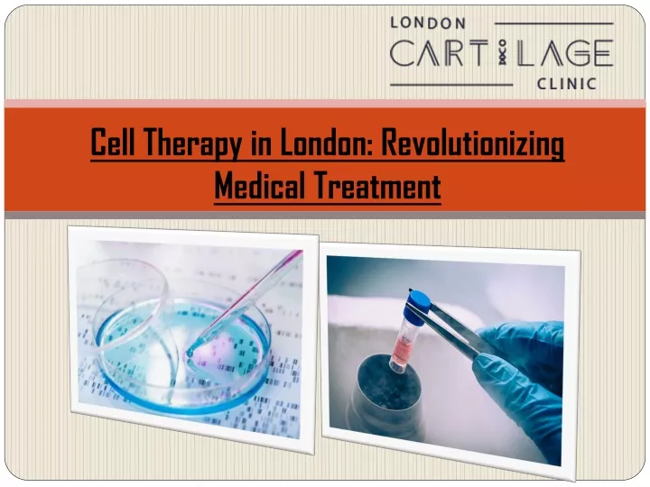 cell therapy in london revolutionizing medical treatment