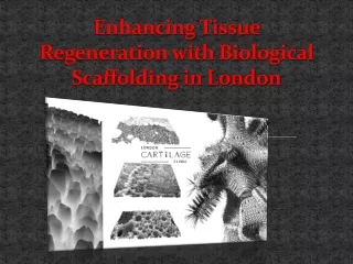 Enhancing Tissue Regeneration with Biological Scaffolding in London