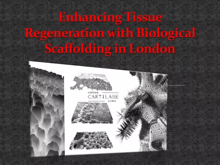 enhancing tissue regeneration with biological scaffolding in london