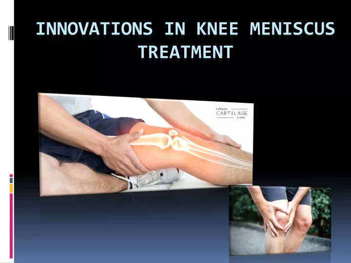 innovations in knee meniscus treatment