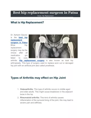 Best hip replacement surgeon in Patna