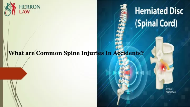 what are common spine injuries in accidents