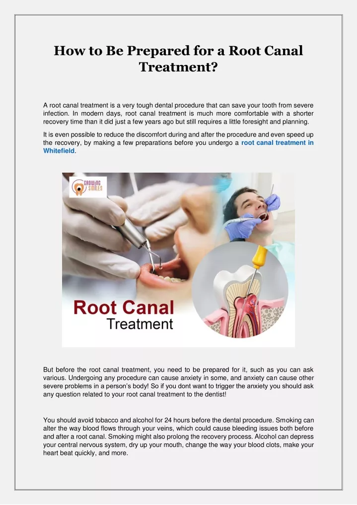 how to be prepared for a root canal treatment