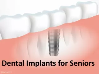 Revitalizing Smiles: Dental Implants for Seniors