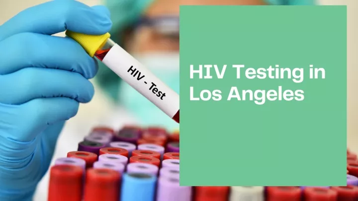 hiv testing in los angeles