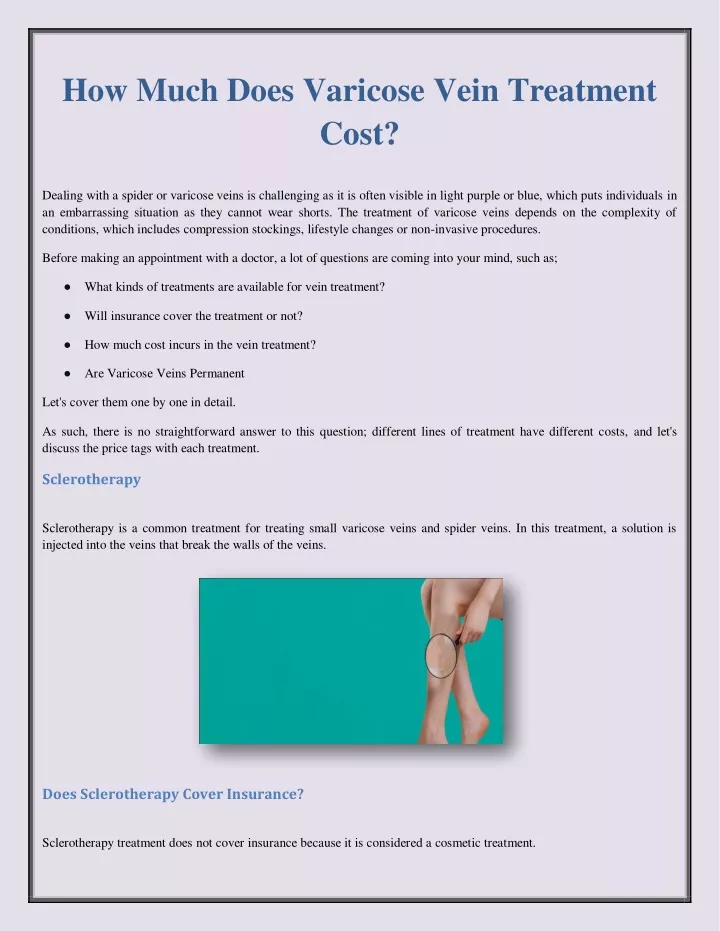 how much does varicose vein treatment cost