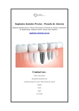 Implantes dentales Precios - Pozuelo de Alarcón