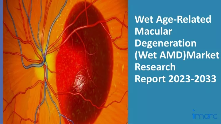 wet age related macular degeneration
