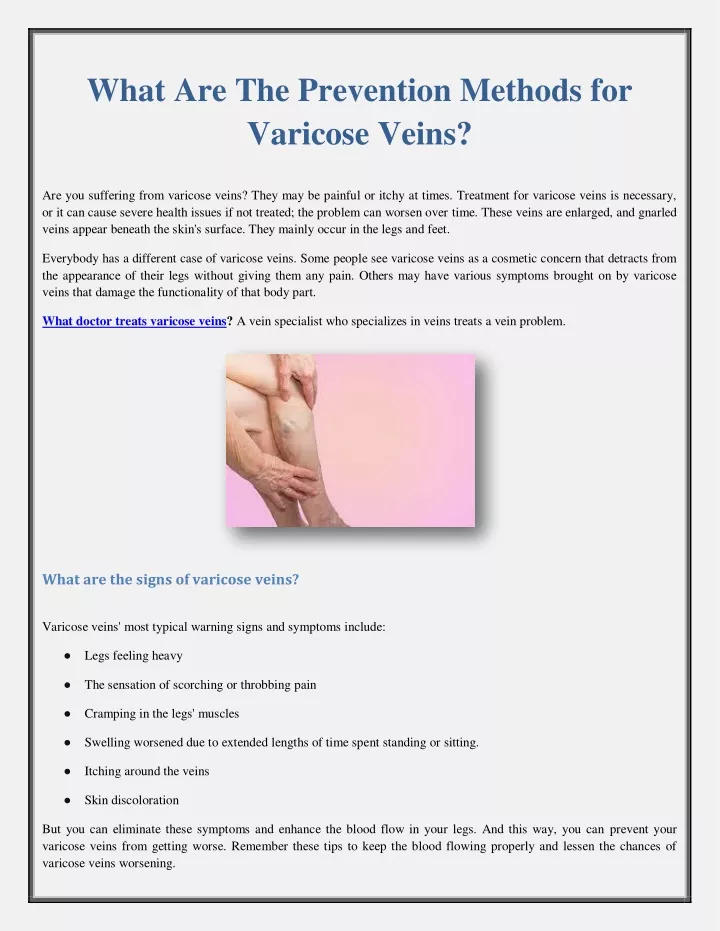 what are the prevention methods for varicose veins