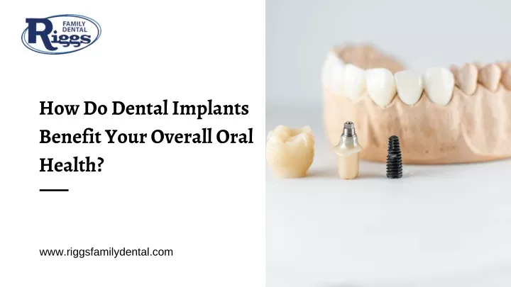 how do dental implants benefit your overall oral