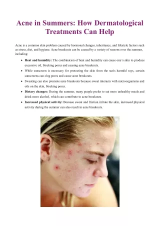 Acne in Summers: How Dermatological Treatments Can Help