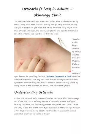 Urticaria (Hives) in Adults – Skinology Clinic