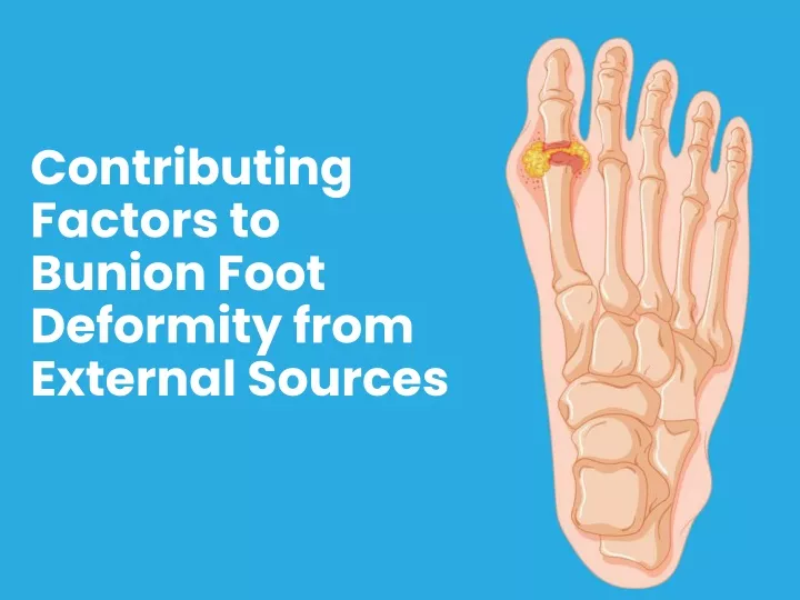 contributing factors to bunion foot deformity