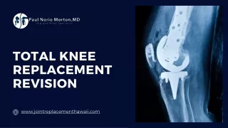 Total Knee Replacement Revision