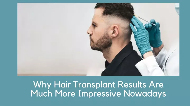 why hair transplant results are much more