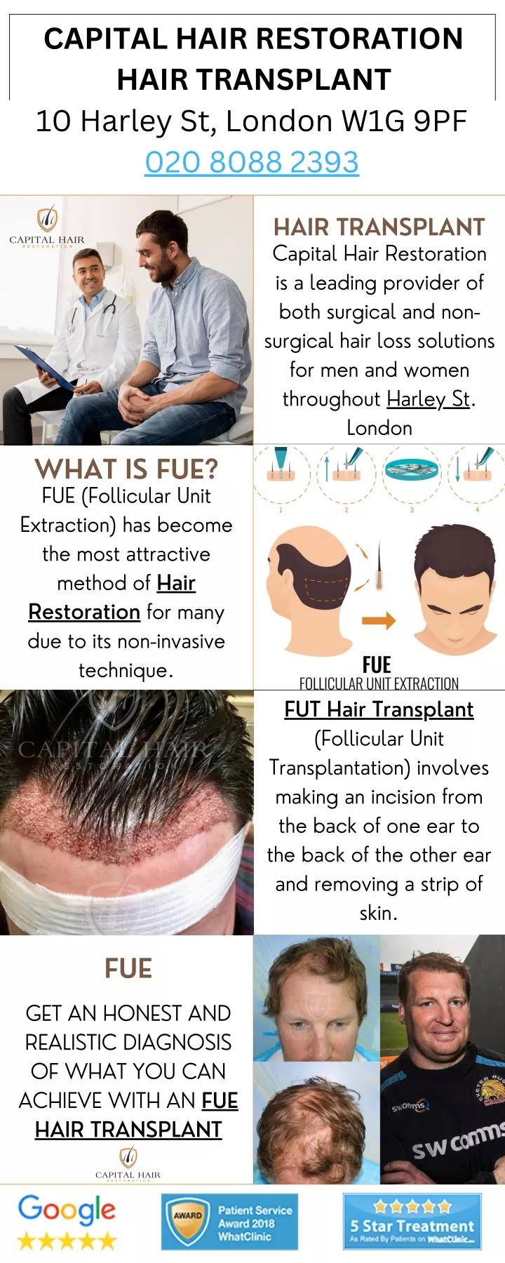 capital hair restoration hair transplant 020 8088