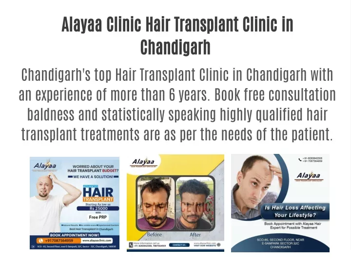 alayaa clinic hair transplant clinic