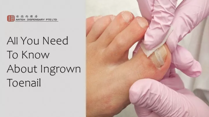 a ll you need to know about ingrown toenail