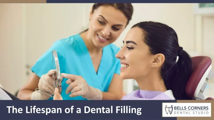 the lifespan of a dental filling