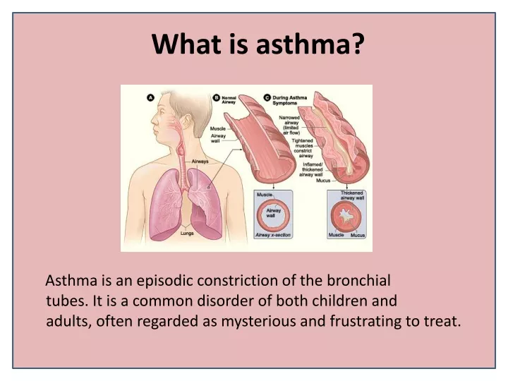 what is asthma