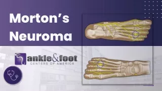 What is a Morton's Neuroma