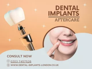 Aftercare of Dental Implants