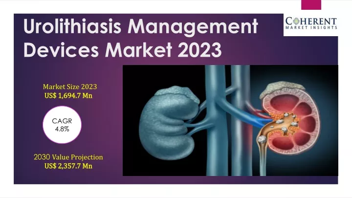 urolithiasis management devices market 2023
