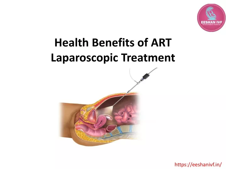 health benefits of art laparoscopic treatment